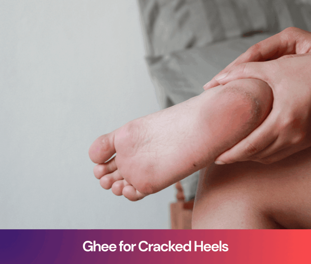 Ghee for Cracked Heels: A Natural Ayurvedic Remedy for Heels and Hands